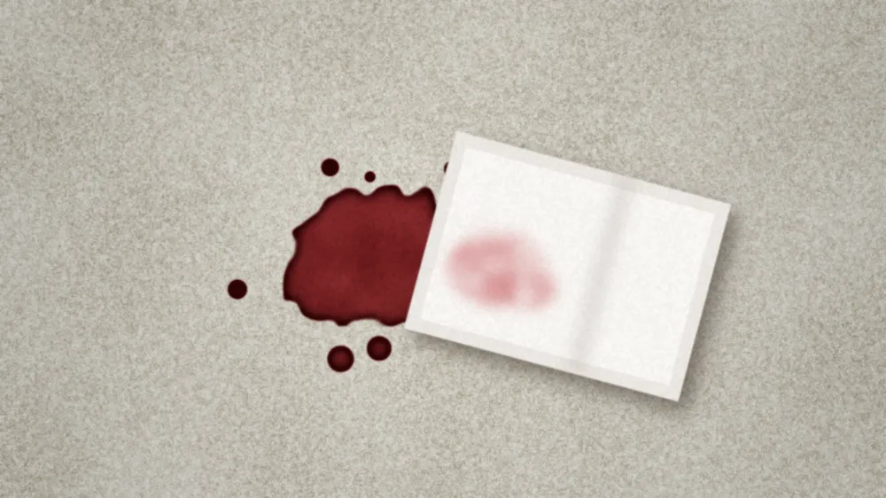 Cold damp white cloth lifting a blood stain from light carpet